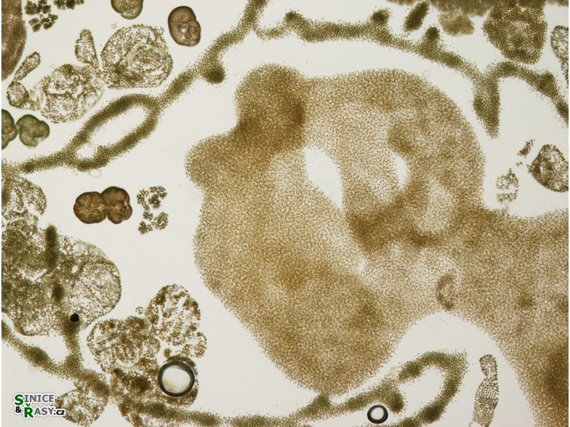 Microcystis spp.