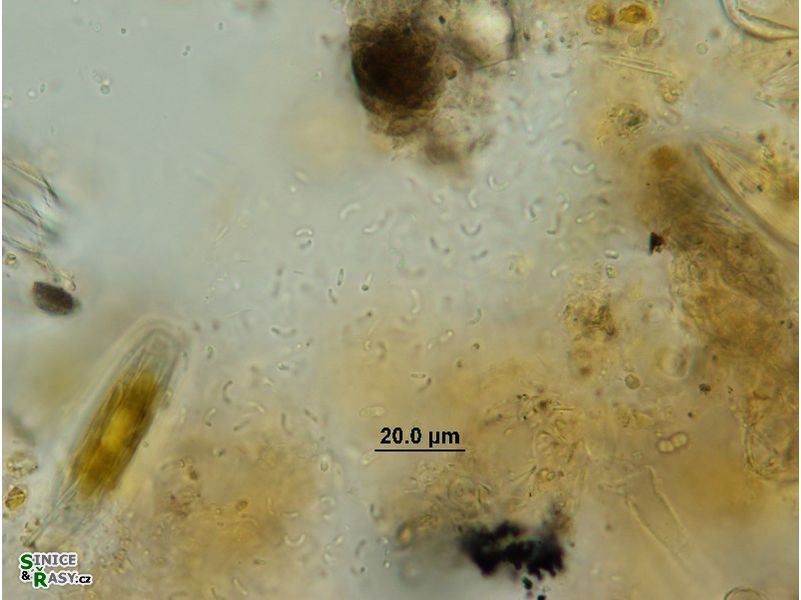 Rhabdoderma vermiculare