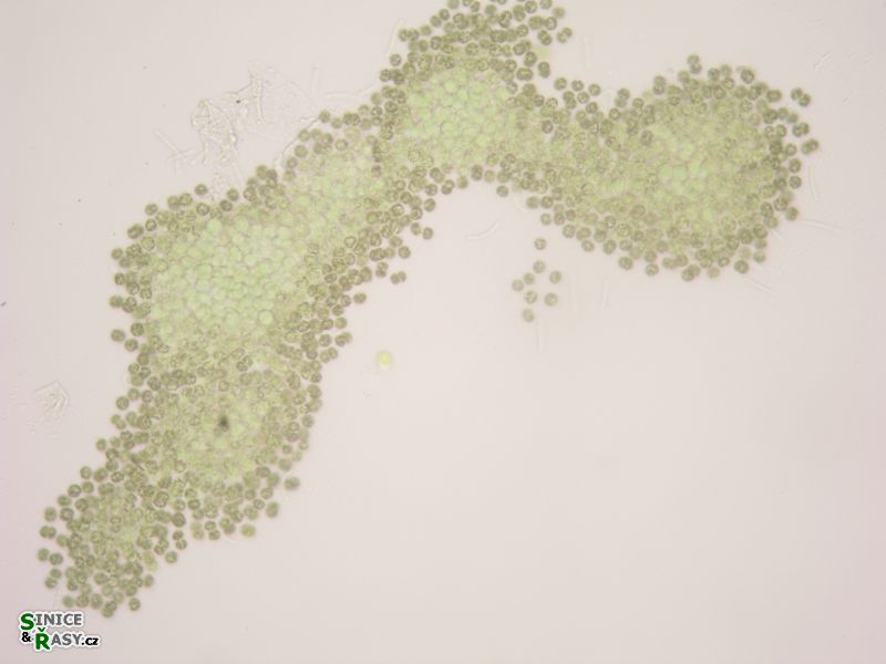 Synechocystis endobiotica
