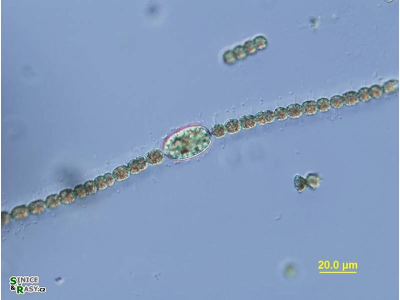 Dolichospermum danicum