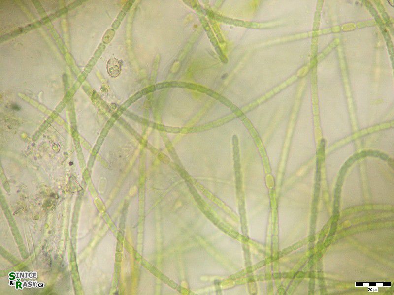Anabaena