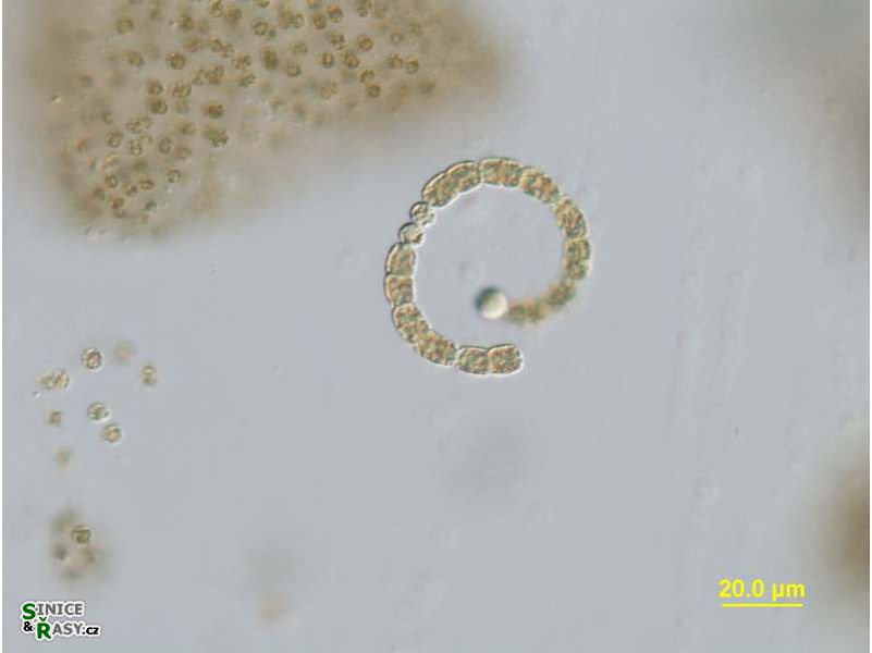 Anabaenopsis