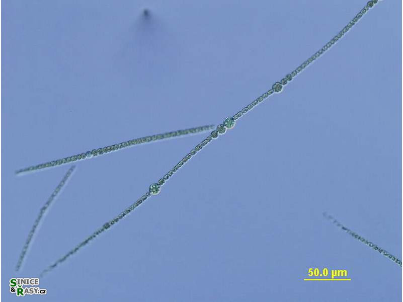 Sphaerospermopsis aphanizomenoides