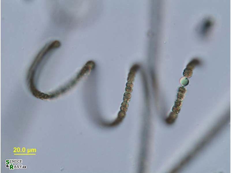 Dolichospermum circinale