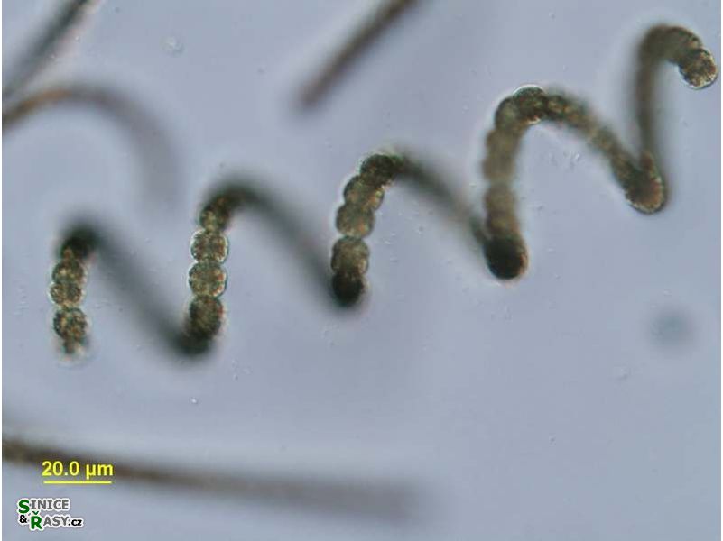 Dolichospermum crassum
