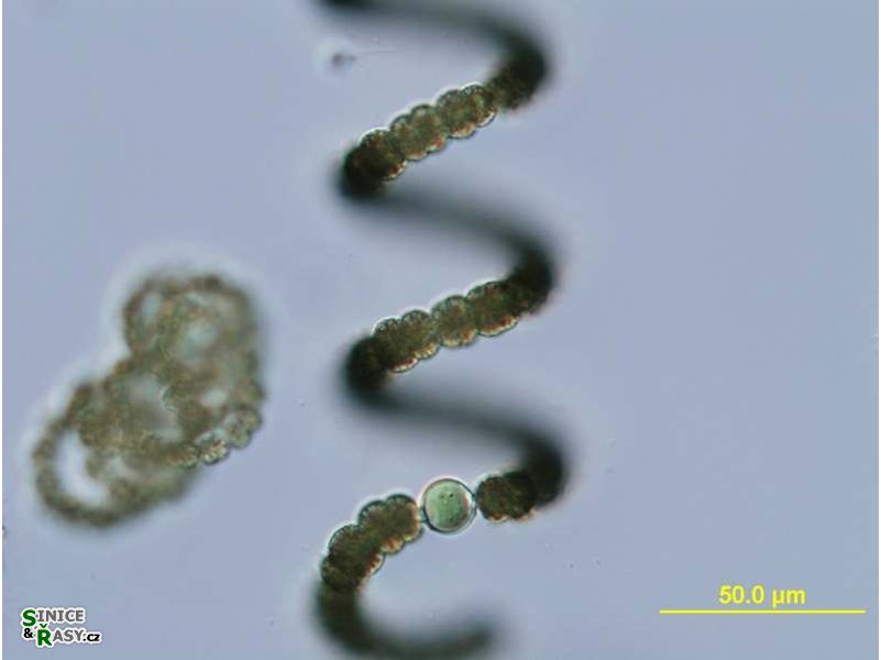 Dolichospermum crassum