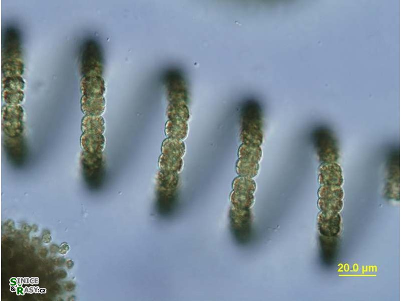 Dolichospermum crassum