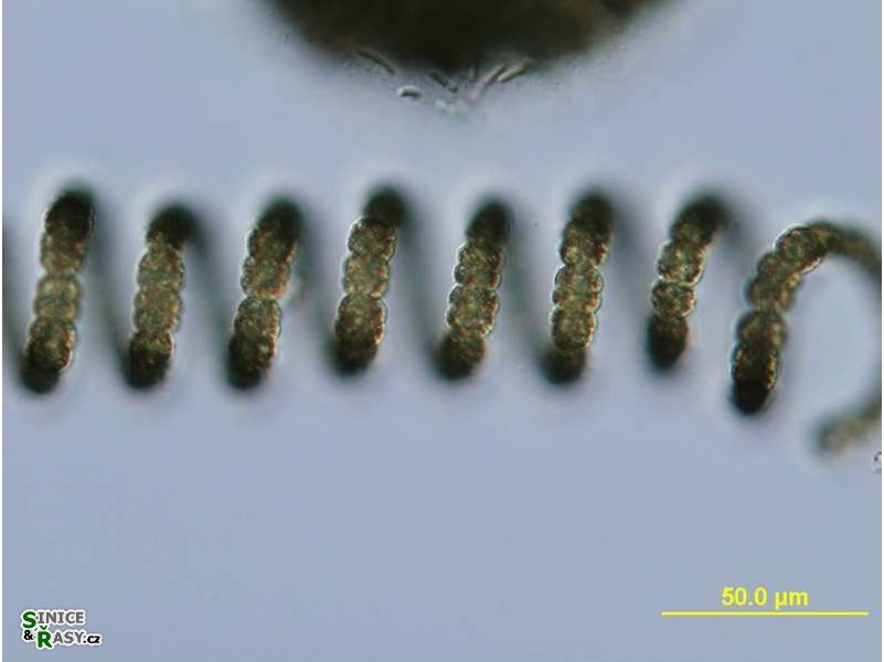 Dolichospermum crassum