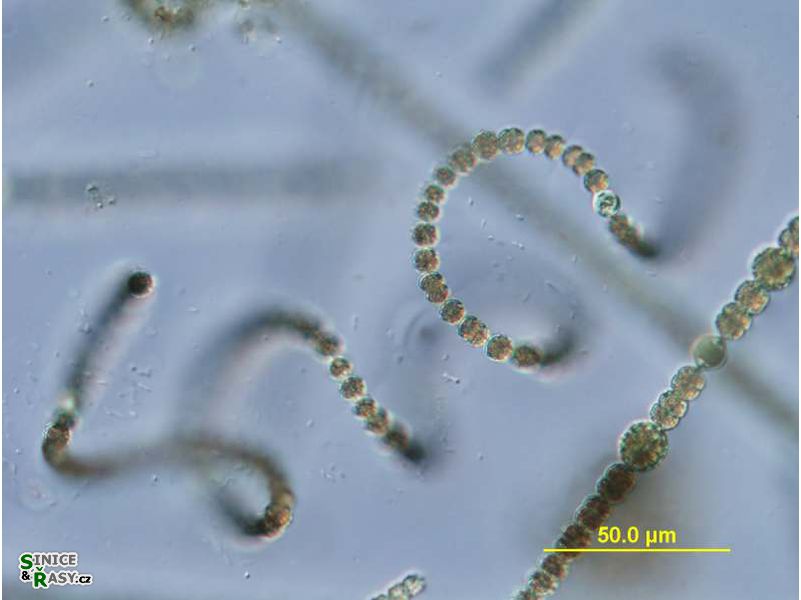 Dolichospermum