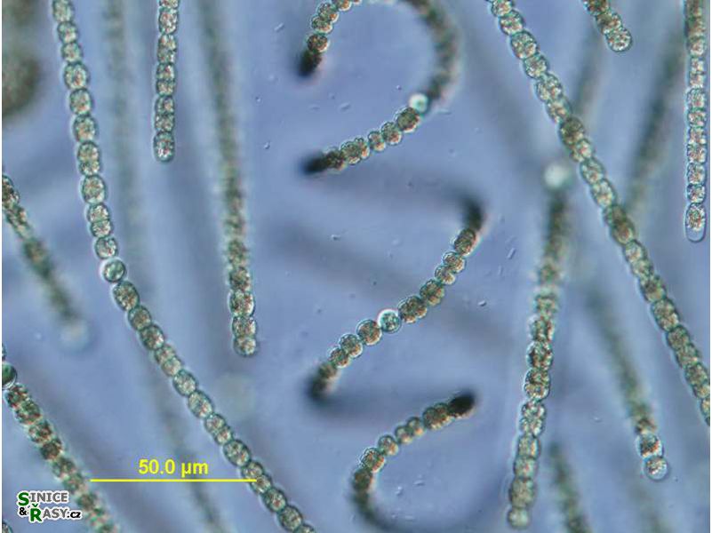Dolichospermum
