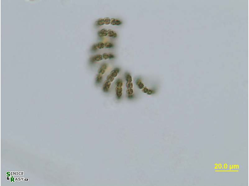 Dolichospermum flos-aquae