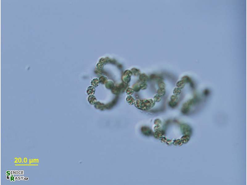 Dolichospermum flos-aquae