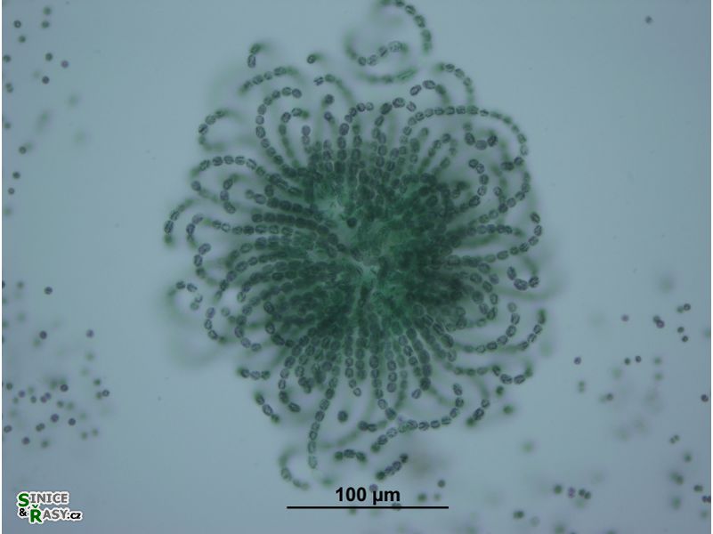 Dolichospermum lemmermannii