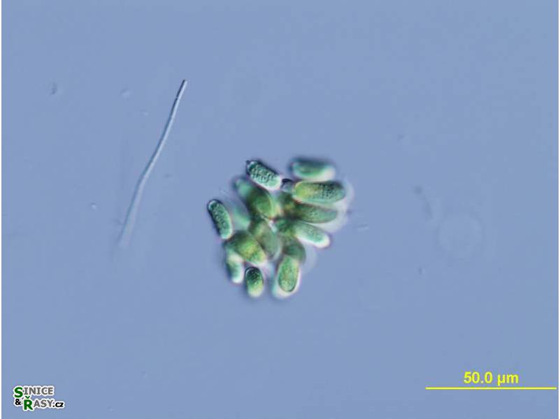 Dolichospermum lemmermannii
