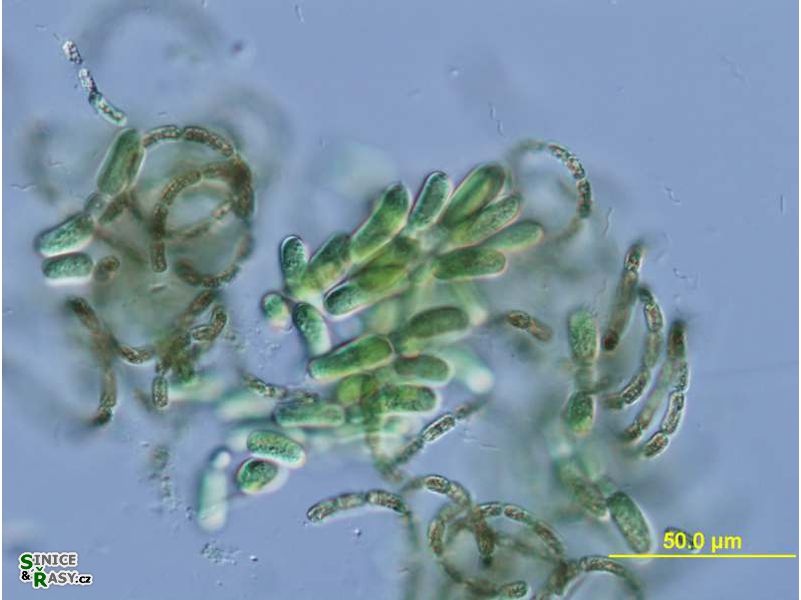 Dolichospermum lemmermannii