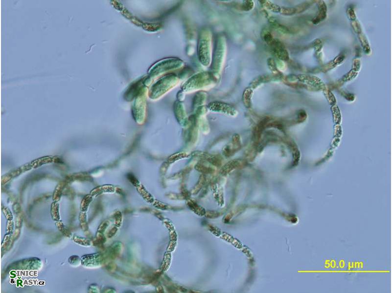 Dolichospermum lemmermannii