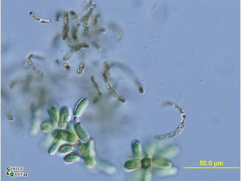 Dolichospermum lemmermannii
