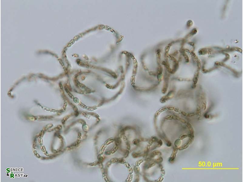 Dolichospermum mendotae
