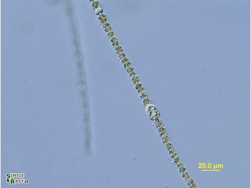 Dolichospermum viguieri