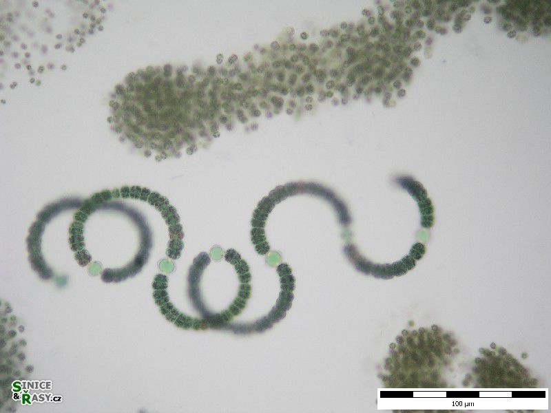 Dolichospermum sigmoideum