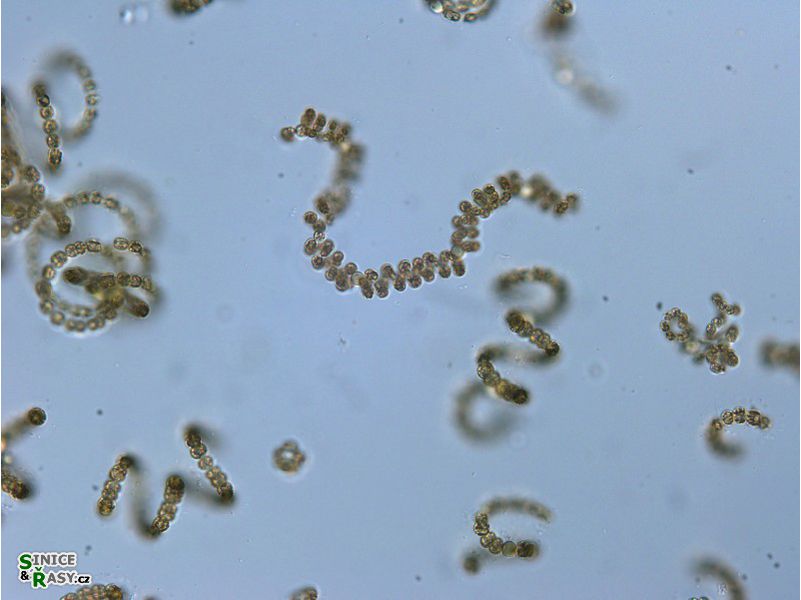 Dolichospermum