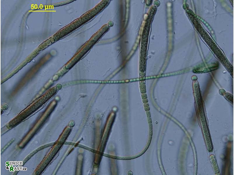 Gloeotrichia natans