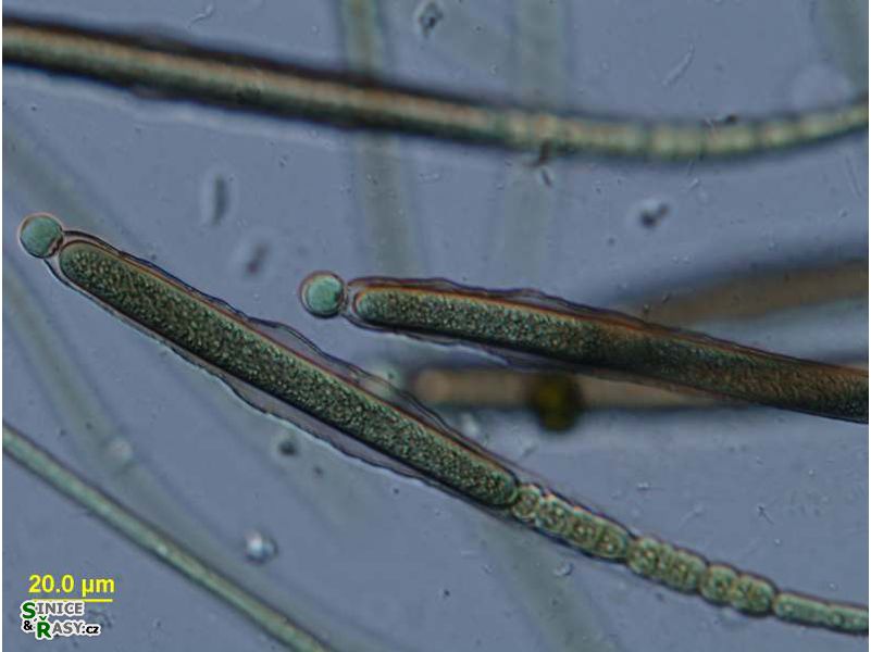 Gloeotrichia natans