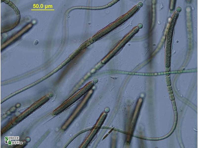 Gloeotrichia natans