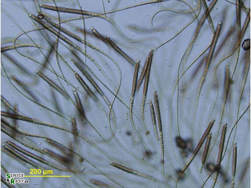 Gloeotrichia natans