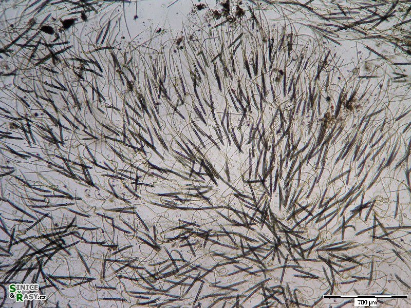 Gloeotrichia sp.
