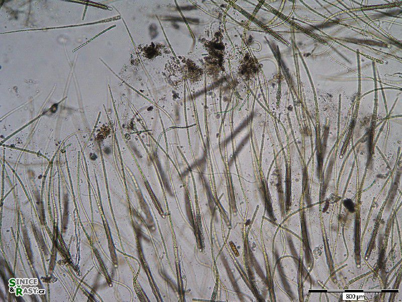 Gloeotrichia sp.