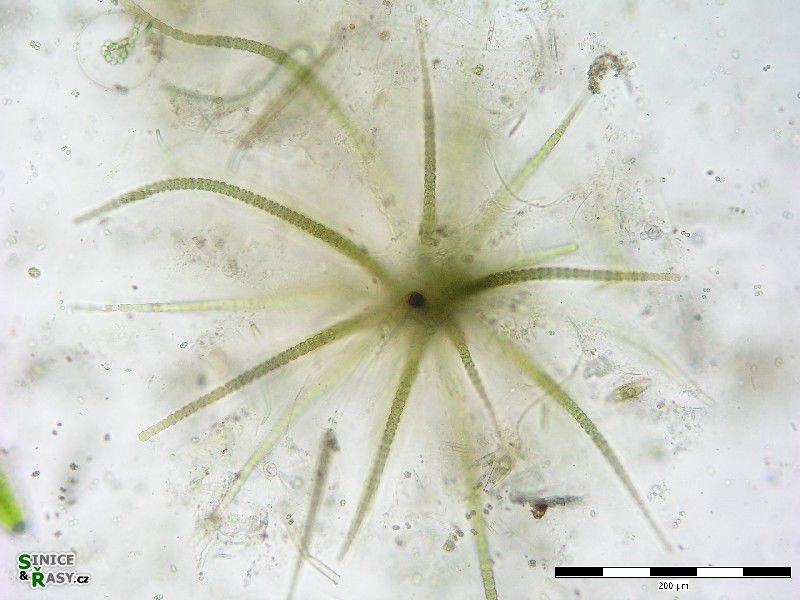 Gloeotrichia sp.