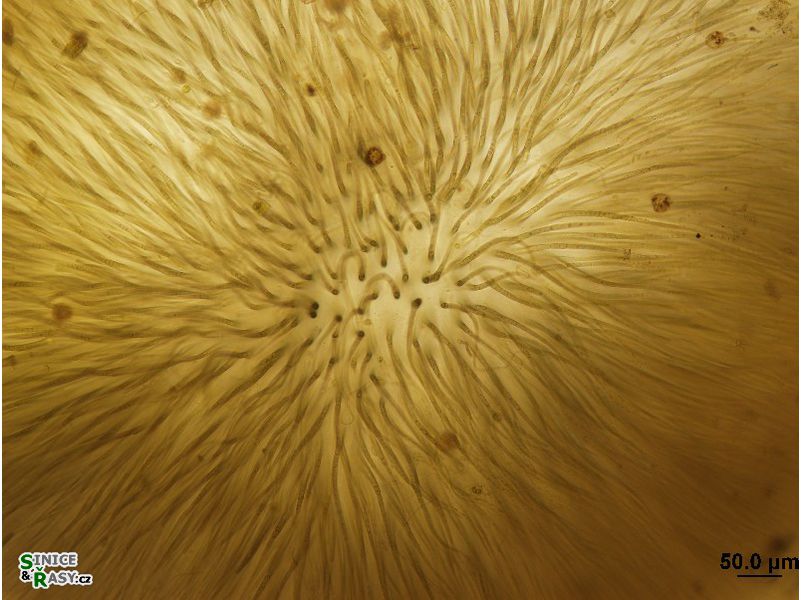 Gloeotrichia sp.