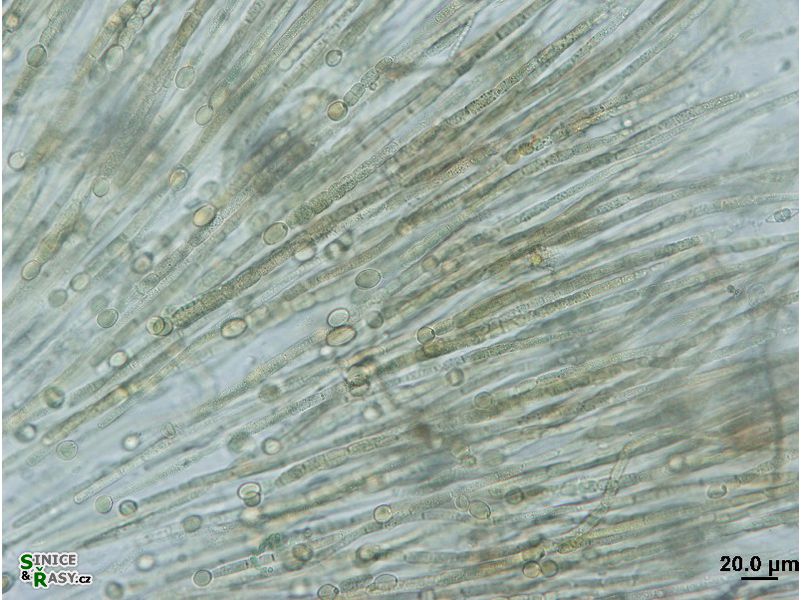 Gloeotrichia sp.