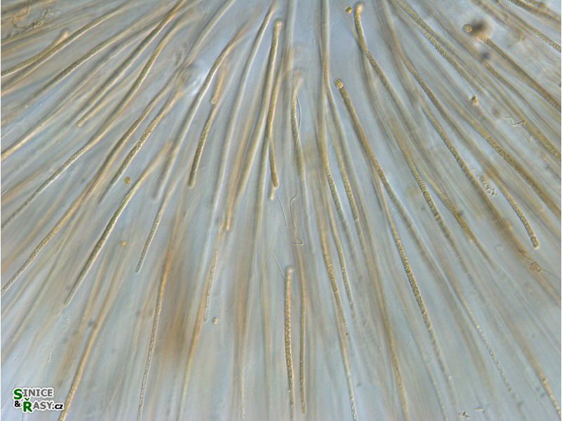 Gloeotrichia sp.