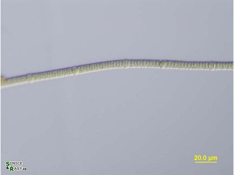 Nodularia
