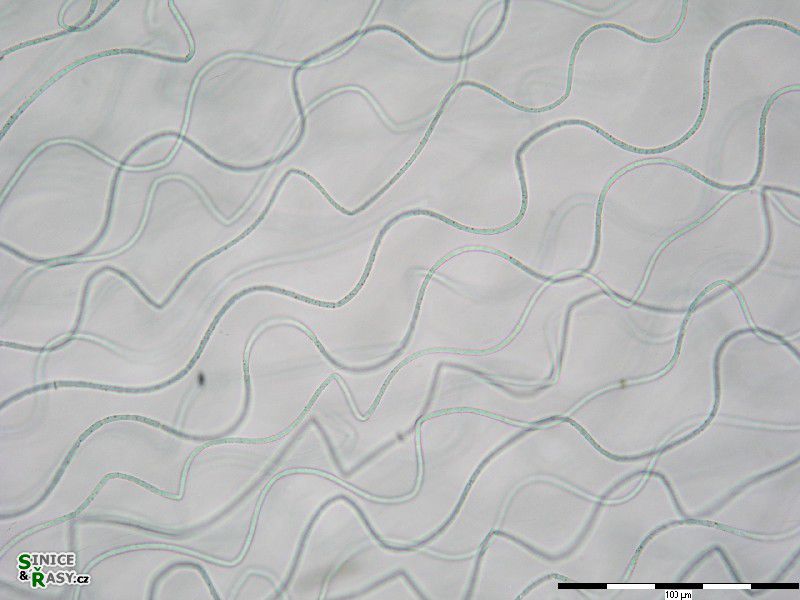 Nostochopsis lobatus