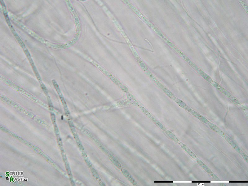 Nostochopsis lobatus