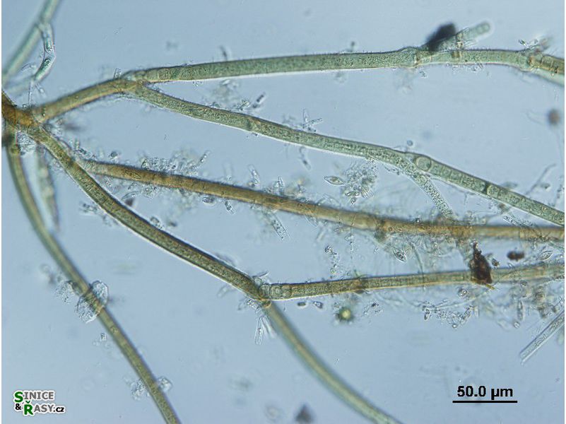 Tolypothrix distorta