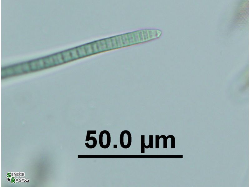 Phormidium autumnale
