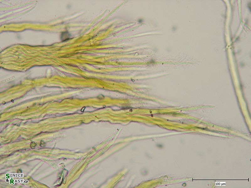 Schizothrix semiglobosa