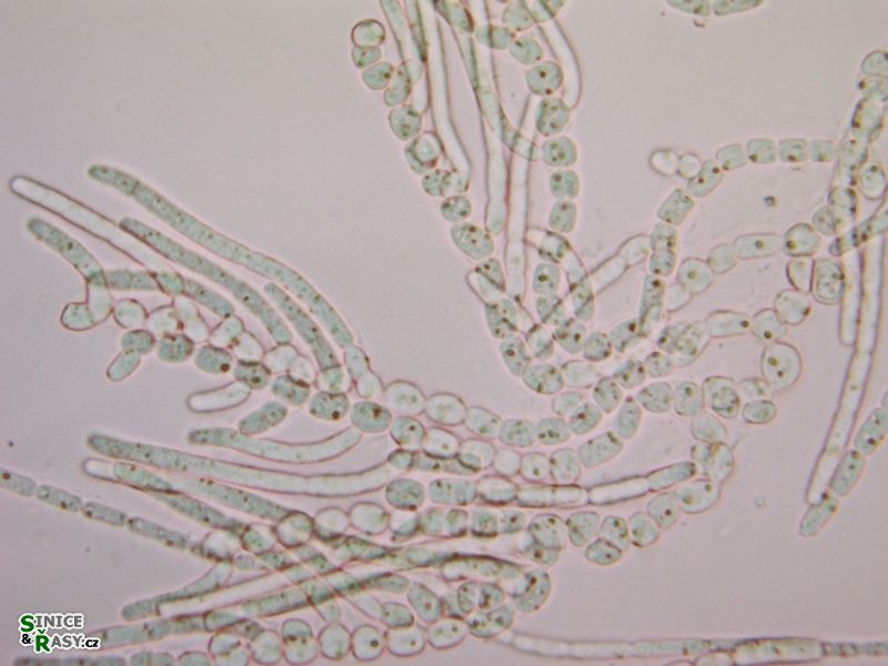 Nostochopsis