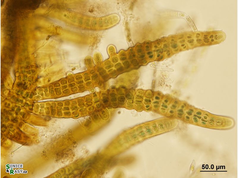 Stigonema mamillosum