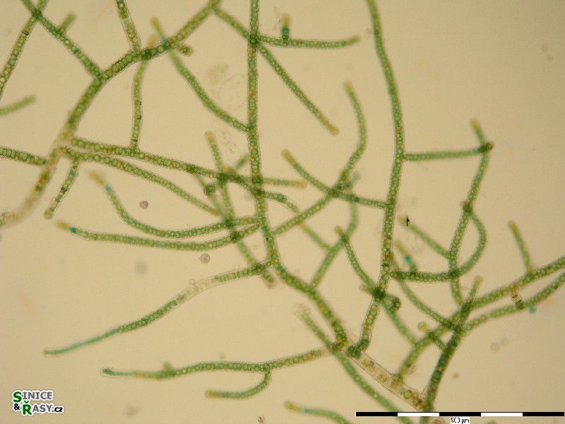 Stigonema ocellatum