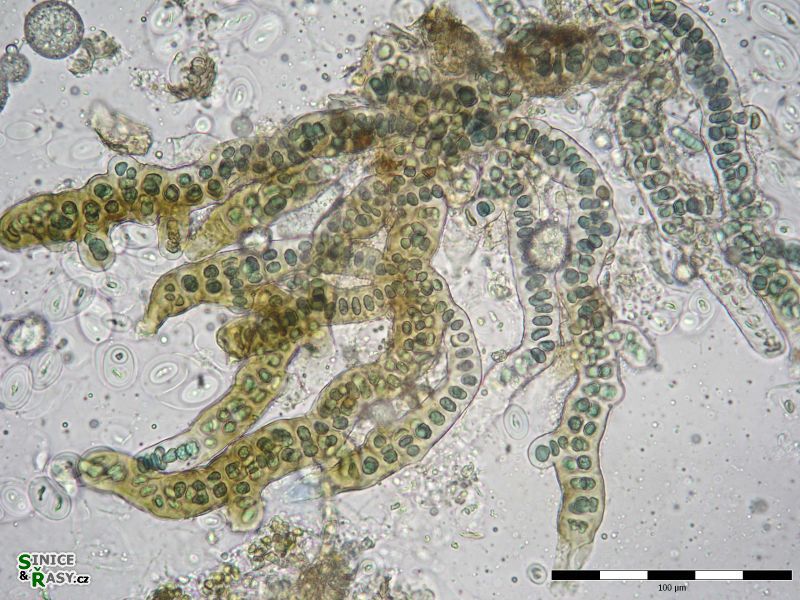Stigonema cf. ramosissimum