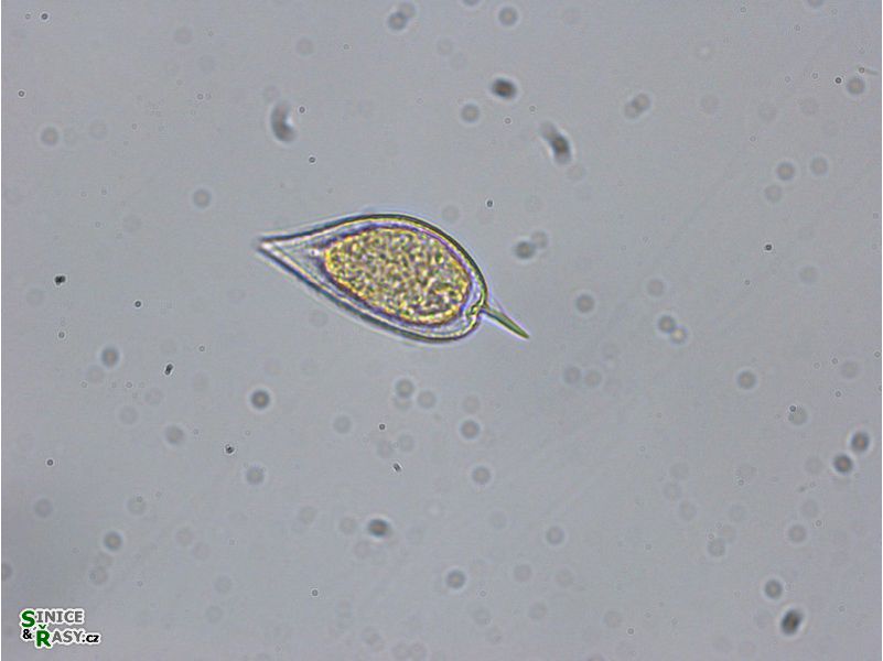 Prorocentrum micans