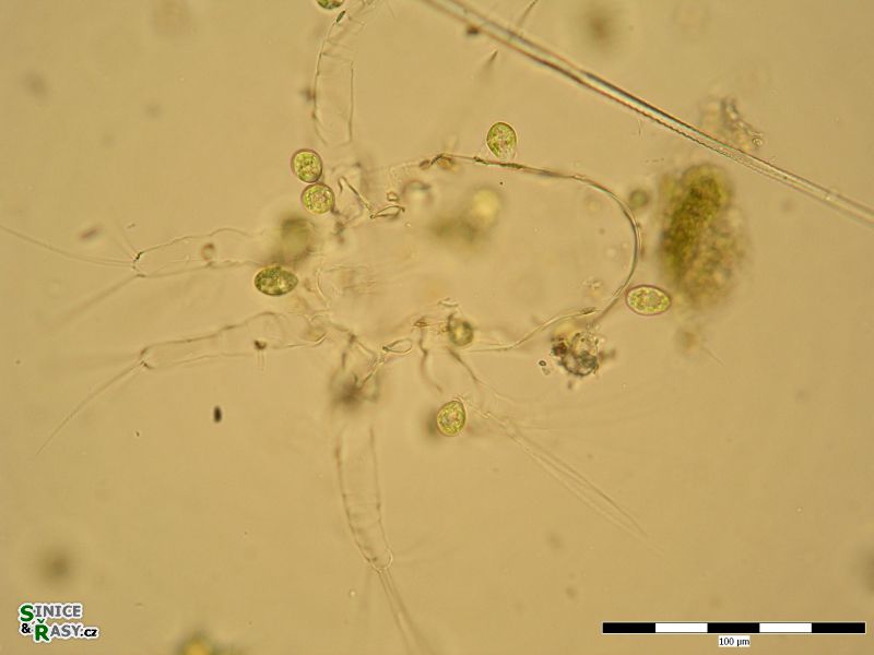 Colacium cyclopicola