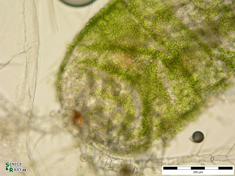 Colacium cyclopicola