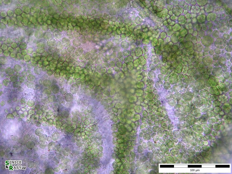 Colacium cyclopicola