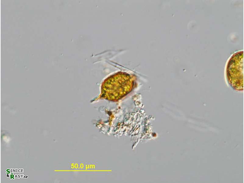 Strombomonas acuminata